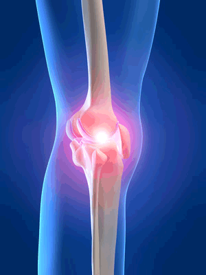 douleurs et inflammation au genou